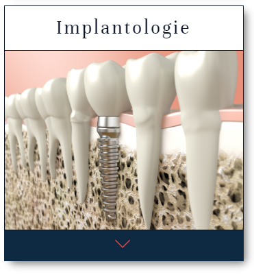 4-implantologie